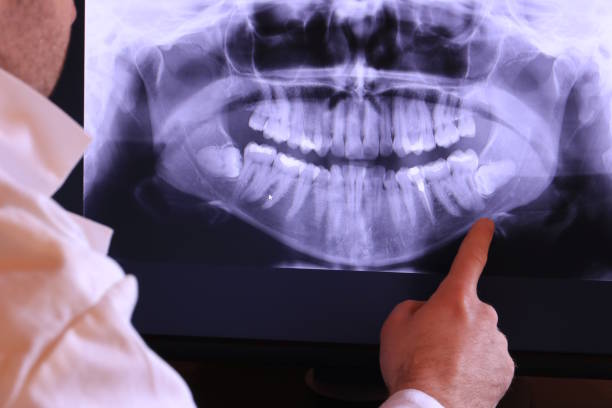 Best Knocked-Out Tooth Emergency  in Homeland, CA